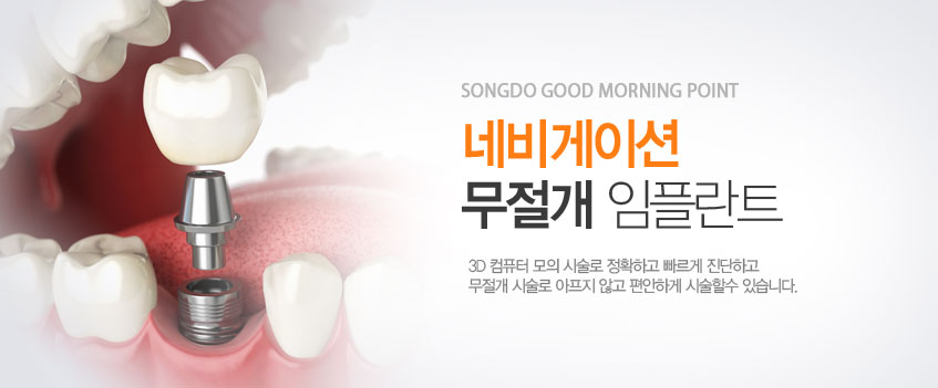 �׺���̼� ������ ���ö�Ʈ