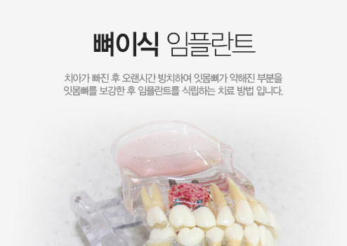 ���̽� ���ö�Ʈ